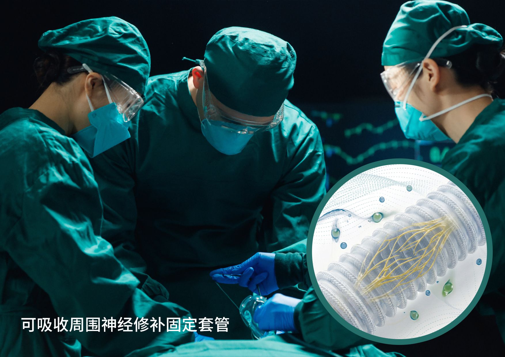 可吸收周围神经修补固定套管
