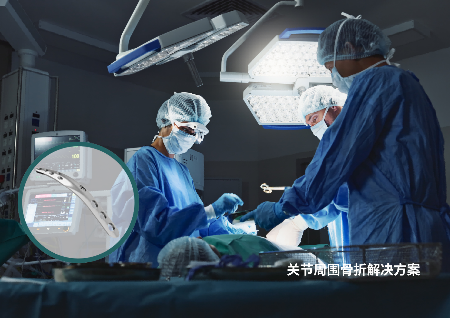 关节周围骨折解决方案
